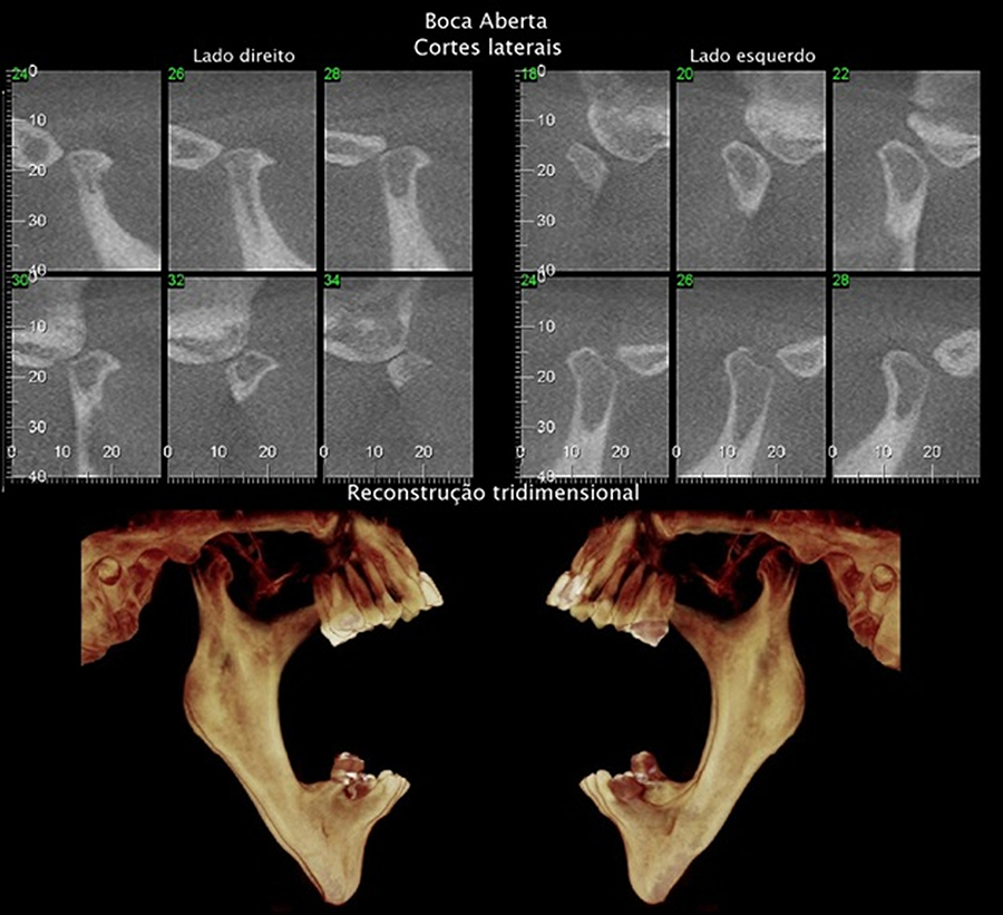 Doctus Premier Odontologia - O que é DTM? A articulação temporomandibular  (ATM) age como uma dobradiça, conectando o maxilar ao crânio. Esta  disfunção pode causar dor e desconforto. Dores na mandíbula, dificuldade