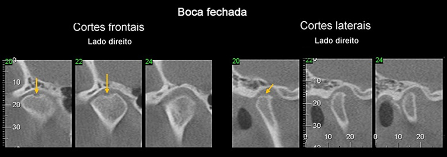 TC DE MANDIBULA • AMD Saúde