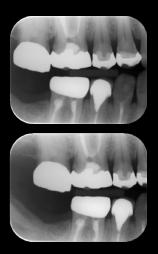 raybellerose também é odontologia 👍 #prognatismo #habsburgo