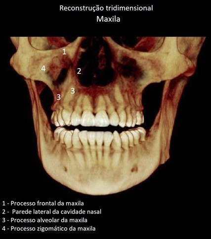 Osso ​ mandíbula (aspecto lateral).