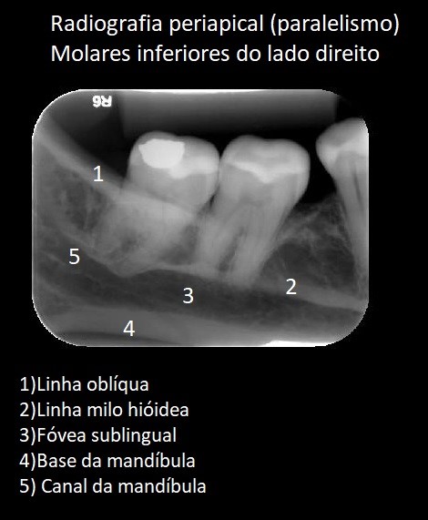 Mandíbula  Anatomia Odonto