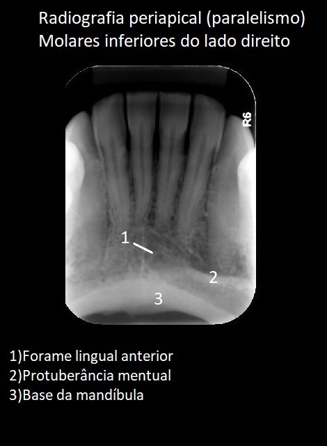 1 pçs dental baixo maxilar mandíbula tecido mandíbula anatômico