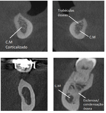 TC DE MANDIBULA • AMD Saúde